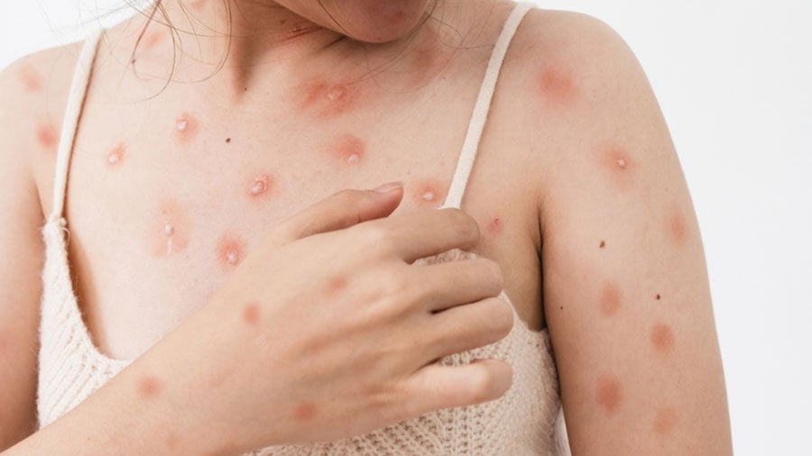 Bu vakaya karşı Türkiye’nin önlem alması gerekiyor