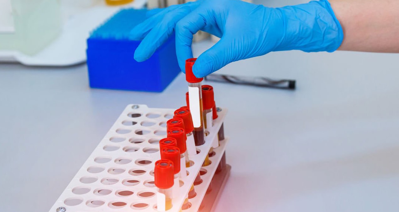 En zeki kişiler bu kan grubuna sahip oluyormuş!