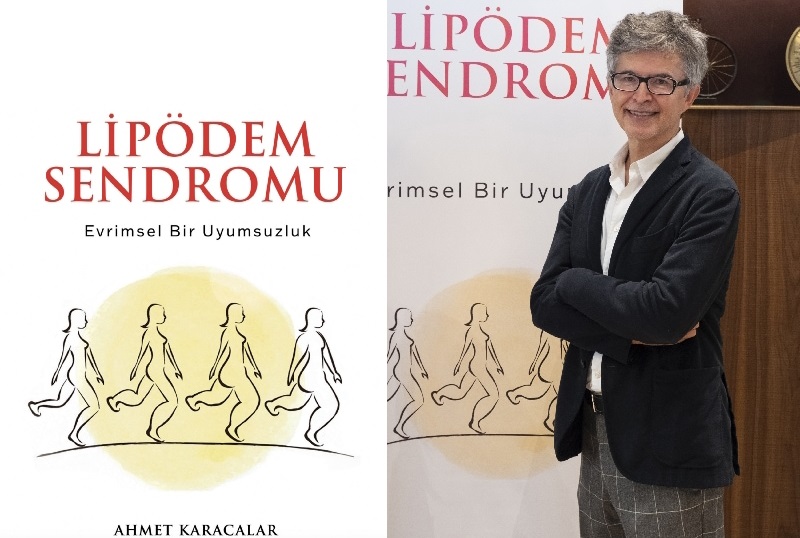 “Diyet Yapıyorum Yüzüm Çöküyor Ama Bacaklarım İncelmiyor” Diyorsanız Dikkat!